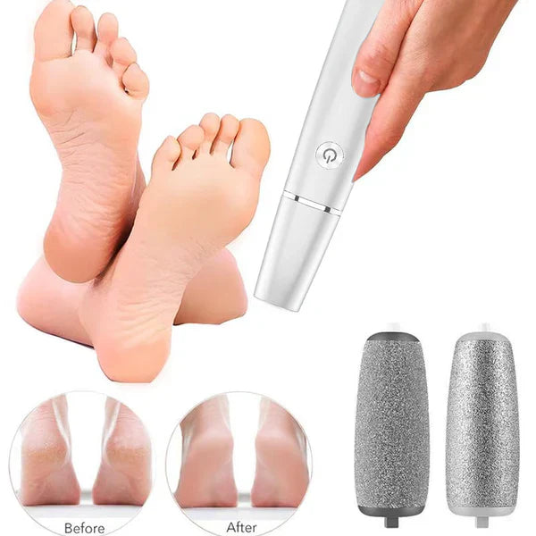 🔥Electric callus remover for feet