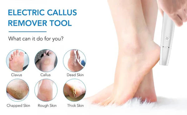 🔥Electric callus remover for feet