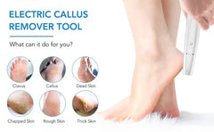 🔥Electric callus remover for feet