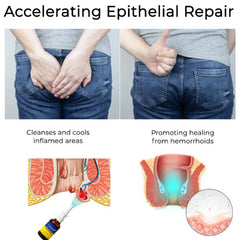 Cvreoz® Herbal Hemorrhoid Treatment Anal Spray (Buy 1 Get 1 Free)